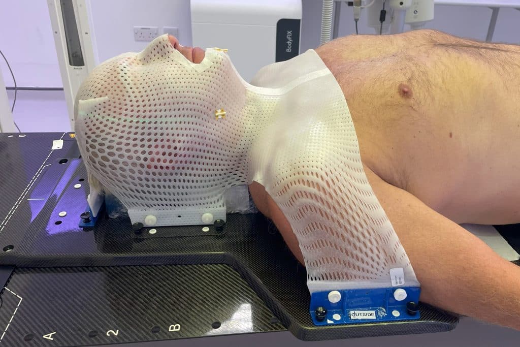 Radiotherapy mask fitting without eyeholes made.