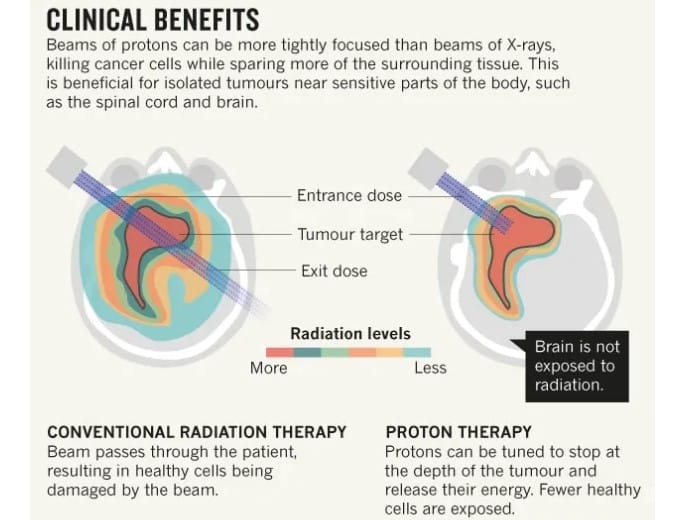 Clinical benefits of Proton beam therapy vs Photon beam therapy