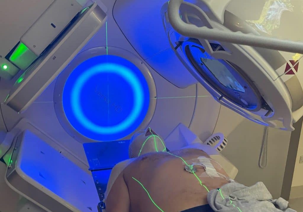 Patient in an ARC photon beam radiotherapy treatment