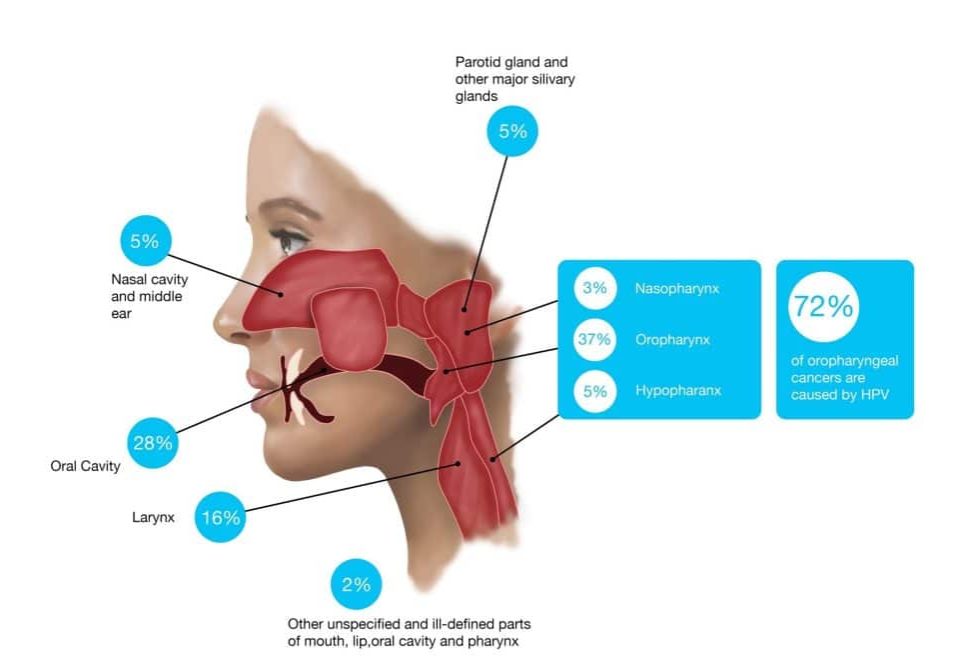 Head and neck cancer type percentages